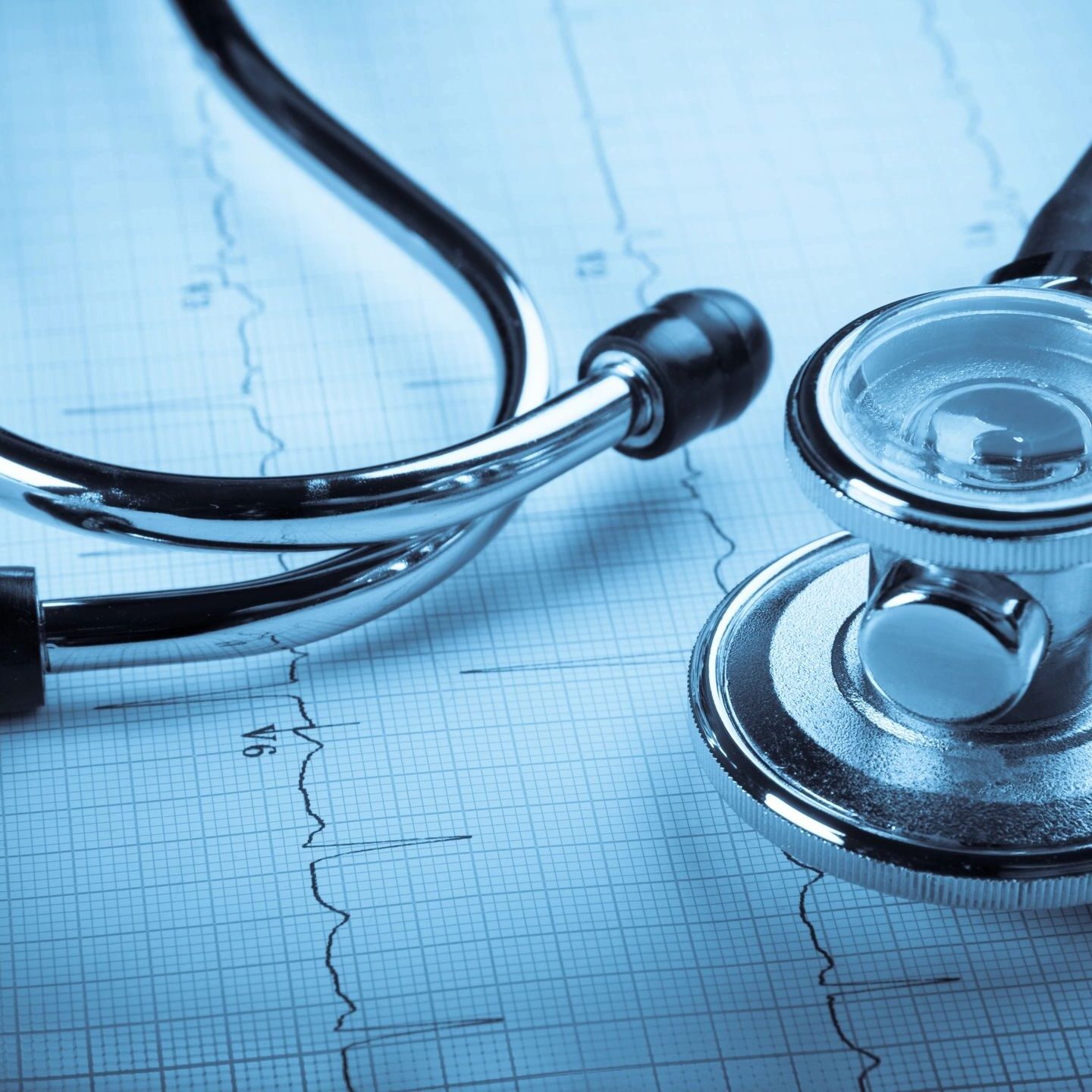 A stethoscope sitting on top of an ecg chart.